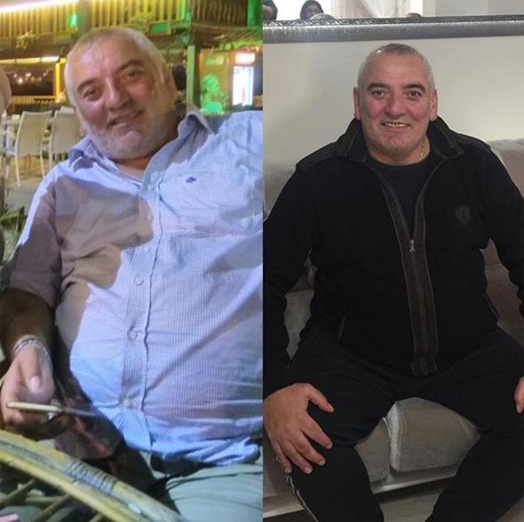 hurriyet.com.tr'ye yaad deiimi anlatan Abidin Yerebakan " Yllarca hep fazla kilom oldu. Son 20 yldr 120 kilonun altna hi inemedim. Salm bozulmaya balamt. Aralk aynda 'Gastrik Mide Bypass' operasyonu geirdim.