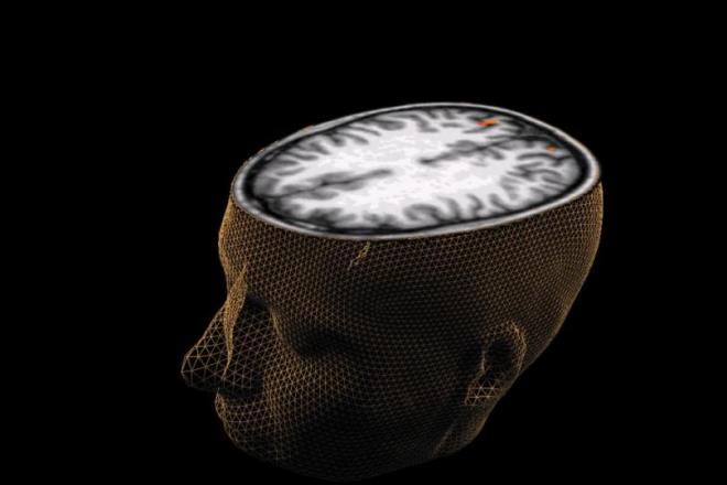 te kiinin IQ seviyesinin ortalamadan yukarda olup olmadnn belirlenmesi iin bavurulan testte yer alan sorular...