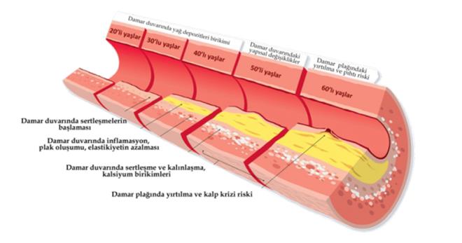 Avrupa Endokrinoloji Dernei Ynetim Kurulu yesi Prof. Dr. Felix Beuschlein ise bbrek st bezi bozukluunun ikincil hipertansiyonun en sk rastlanan nedeni olarak kabul edildiini dile getirdi.