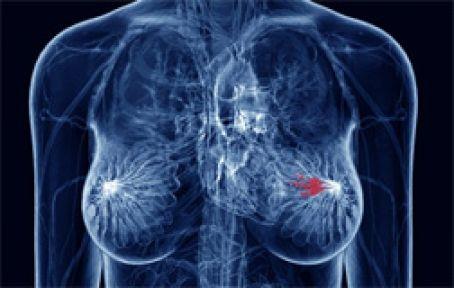 <p><b>MEME KANSER:</b></p> Erkeklerde yz binde 0.8, kadnlarda 40.7