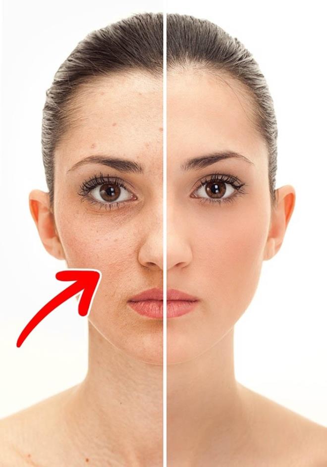 9- Yalanmay geciktirir  Gnde iki yumurta yiyen 35-40 ya arasndaki kadnlarn yzde 87'sinde ya lekeleri kayboluyor ve cilt yenileniyor. Erkeklerdeyse gz evresindeki krklklar gzle grlr ekilde yok oluyor.