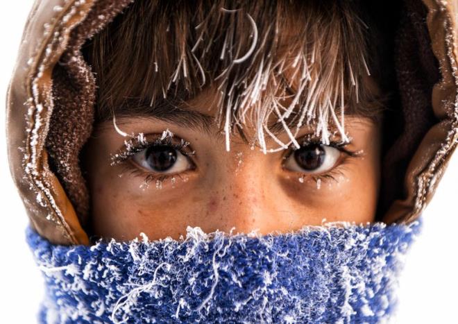 Dou Anadolu Blgesi'nde souk hava yaam olumsuz etkiledi. Ardahan'da okula giden ocuklarn ka ve kirpikleri dondu. Gnay Nuh