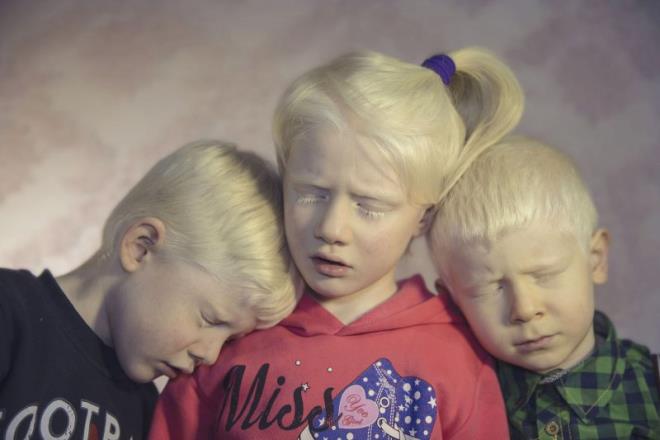 Trkiye'nin beyaz melekleri olarak nitelendirilebilecek "Albinolar", kimi zaman hayallerinden feragat etmek zorunda kalsalar da yaamlarn normal insanlar gibi srdrmeye alyor. Ten renklerinin farkll nedeniyle "Albino" olarak bilinen albinimzli bireylerin kimi askerlii dlyor, kimi gneli bir havada uzun uzun denizi izlemeyi, kimisi de zgrce sokaklarda mziini yapmay istiyor. Albinizmli bireylerden stanbul'da yaayan kardeler Cem (solda), Cemre (ortada) Akpnar ve arkadalar Furkan zorman (sada). ebnem Cokun