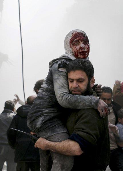 Suriye&#8217;de sivillere saldrlar: Suriye'nin bakenti am'n Dou Guta blgesindeki Hamuriye beldesine dzenlenen hava saldrsnda 12 sivil ld, ok sayda kii yaraland. Saldr sonucu yaralanan bir kz ocuu sivil savunma ekipleri tarafndan blgeden uzaklatrld. Samir Tatin