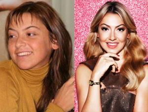 Hadise