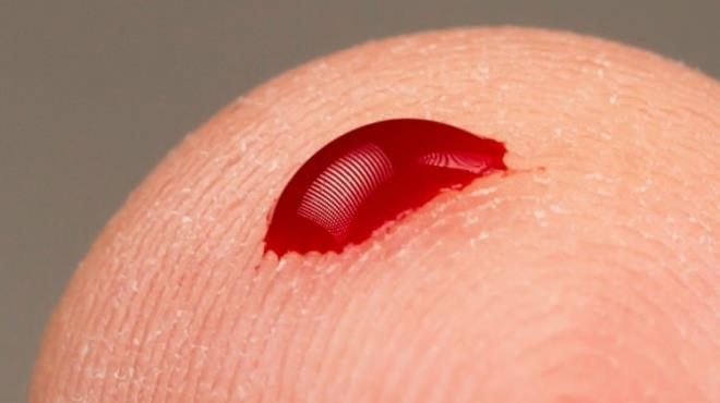 AB kan grubu beslenmesi    Yanl beslenmeye bal olarak grlen gereksiz kilo art iin tavuk, msr, nohut, fasulye ve buday tketmemek gerekir.