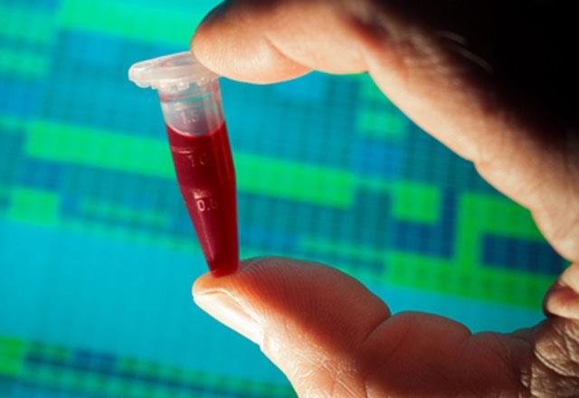 0 kan grubu beslenmesi    0 kan grubuna sajip kiiler, depresyon ve tiroid rahatszlklarna daha kolay yakalanabilirler. Zayflamak iin hayvansal gdalarn doal olmas ve ya orannn az olmas nemlidir.