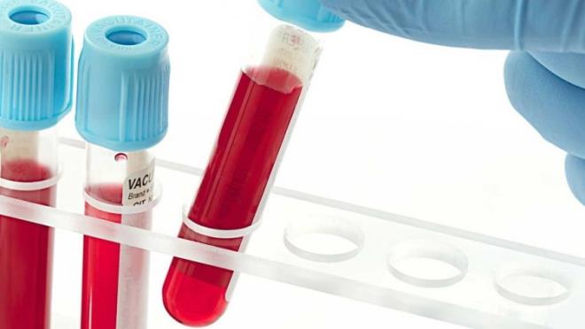 B kan grubu beslenmesi    Stresi en ok tolere edebilen B kan grubuna sahip kiiler, doru bir ekilde beslenmezlerse MS, diyabet ya da lupus hastalna yakalanabilirler. Bu nedenle et ve sbzeyi dengeli bir ekilde tketmelilerdir. Ayrca st ve st rnlerini de kolaylkla sindirebilirler.