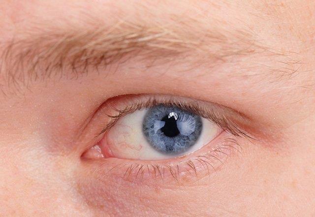 NCE KALAR  Kalarnzn gittike seyreklemesi, hormon dzeylerinizin dengesiz olduunu, yani tiroit bezinizin yeterli almadnn bir gstergesi olabilir. Cilt kuruluu, kilo art, kabzlk ve yorgunluk tiroid bezinin az almas durumunda sklkla karlalan dier sorunlardr. Bu sorunlardan bir kana sahipseniz, tiroidinizin altndan emin olmak iin test yaptrabilirsiniz.