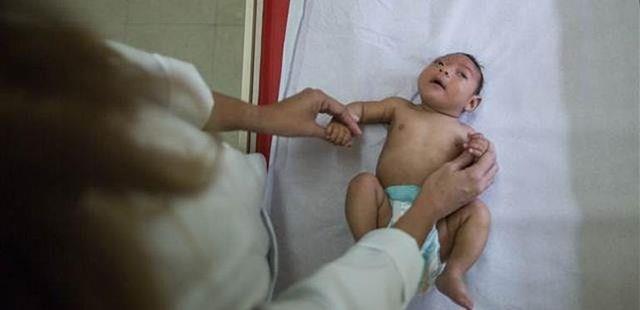 ZKA VRS NEDR?  Flavivirus grubundan bir RNA Virs olan Zika virsnn neden olduu ve insanlara sivrisinek srmas ile bulaan bir hastalktr. lk olarak Uganda?da 1947?de Zika Orman?nda bir Rhesus maymununda kefedilmitir. nsanlarda ilk olarak 1954?de Nijerya?da bulunmutur. Belirtileri ate, baars, kzark gzler, dknt, kas arlar ve eklem arlar olabilir. Genellikle hafif geen bir hastalktr, 4-7 gn srer.