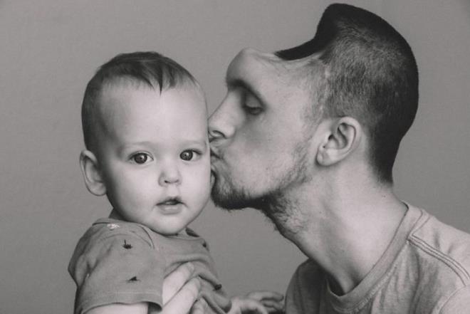 O gece uyurken, btn dnyamn birka saat iinde parampara olacan hayal etmemitim. Annemin beni uyandrp "Austin bir kaza geirdi" dediini hatrlyorum. Tek bildiim kocamn hastanede olduuydu ve nedenini bilmiyordum.