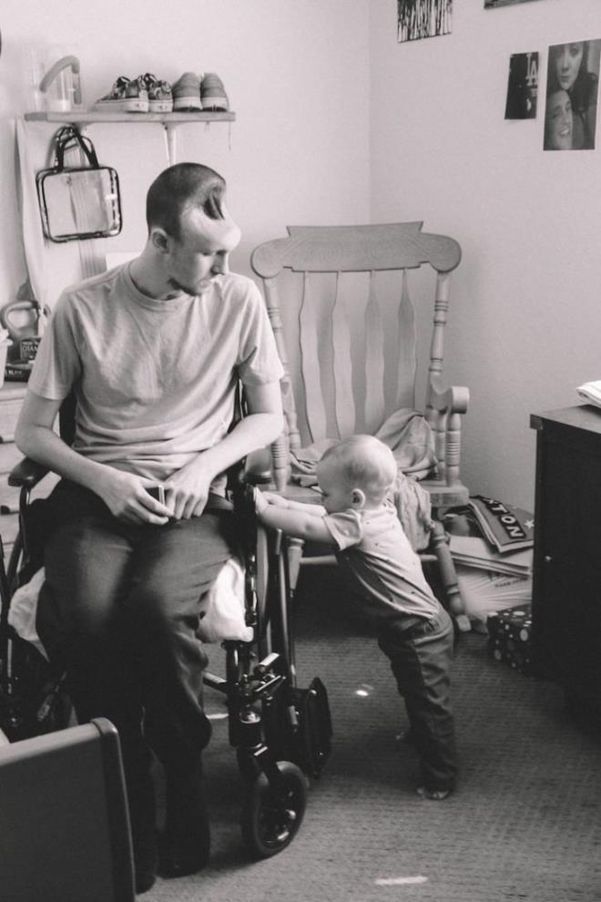 Sevdiim ve paras olmaktan mutluluk duyduum yeni ailemin bu hlini izlemekten daha kt bir hisle tanmadm. Austin'in, kafatasnn nnde onarlamaz bir delik vard ve ei ilk ocuunu dourmak zereydi. &#8226; Ertesi gn iki ameliyat daha geirdi. Ardndan fel gibi hazrlkl olmadmz baz eylerle karlatk. Austin hastanede yatarken, sadece iyi olmas iin dua ediyordum ve ondan asla vazgemeyeceimi biliyordum. Ne kadar dank olursa olsun hayatmz yeniden toparlayacaktk ve ben onun tarafnda olacaktm.