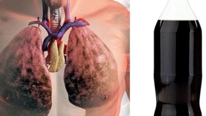 Inman'n lmnn ardndan aklama yapan doktor Deirdre McKenna, gen adamn ocukluundan bu yana ar derecede kola ve benzeri gazl iecekler tkettiini ve bu durumun ciddi boyutlarda bir akcier demine sebep olduunu aklad.