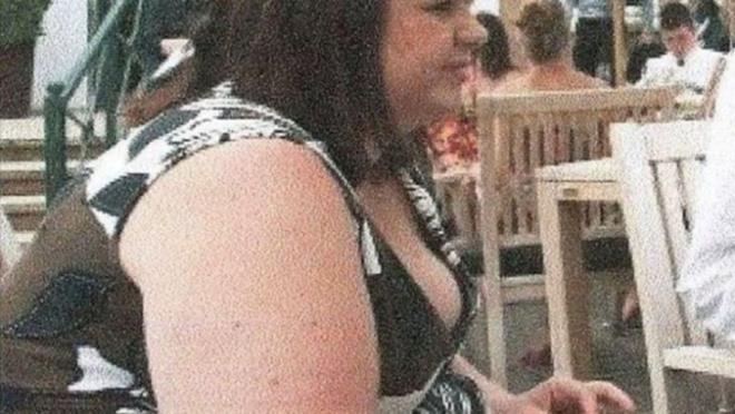 ngiltere'nin Birmingham ehrinde yaayan Lisa Mckay (24) yakn bir zamana kadar gnde tam 20 kutu Cola iiyordu.