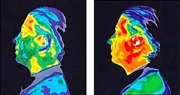 zgl emilim oran (SAR), bir radyo frekans (RF) elektromanyetik alana maruz kaldnda insan vcudu tarafndan radyasyonun emilme hznn bir lmn ifade ediyor. Bununla birlikte, ultrason da dahil olmak zere etrafmzda kullandmz birok ey doku yoluyla emilime sebep olabilir. Cihazlarda verilen oran, dokunun ktlesi bana emilen enerji olarak tanmlanr ve kilogram bana watt birimine (W / kg) sahiptir.