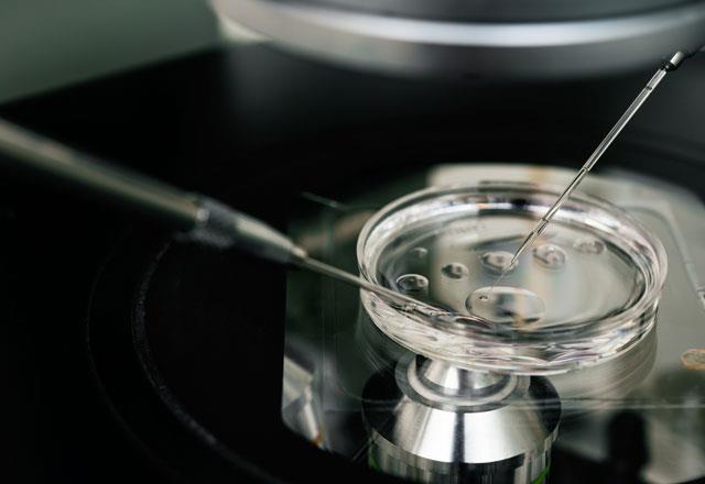 Erkek ksrlk belirtileri<p>       Erkein sperm says ya da kalitesi dkse hamileliin olumas zordur, hatta imkansz bile olabilir.<p>       ocuk sahibi olmakta zorlanan 5 iftten 1 tanesinde erkek ksrln ana nedenidir.<p>       20 erkekten 1 tanesinde dk sperm saysna bal olarak ksrlk sorunu olduu tahmin edilmektedir.<p>       Ksr erkeklerin 8'inden sadece 1 tanesinin ksrlk sorunu tedavi edilebilir.   <p>    Baz durumlarda doktorlar tp bebek tedavisini nerebilir.