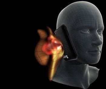 Elektromanyetik dalgalar enerjilerine gre iyonlatran ve iyonlatrmayan radyasyon diye ikiye ayrlr. yonlatranlar esas zararl olan dalgalardr, x-ray gibi. Ik ve radyo dalgalar gibi iyonlatrmayan radyasyon ise zararszdr.