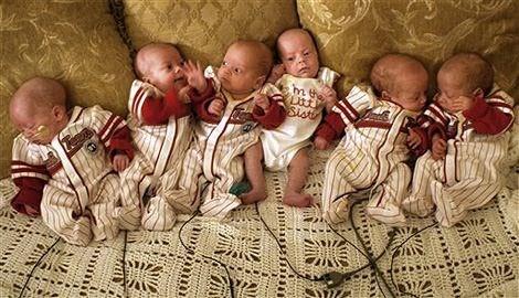 OUL GEBELKLERDE BEBEKLER CDD RSKLER BEKLYOR  <br> Dnyada beiz, altz, yediz gibi vakalar olmutur lakin tm bebeklerin salkl olduu ve gebeliin mutlu sona ulat oul gebelik neredeyse milyonda birdir. Gebelik haftas azaldka ve kilosu dtke bebein youn bakma girme ve lm riski, yaad takdirde ise sekel kalma ihtimali artar.&#8221;