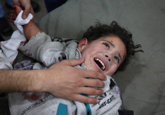 Halk nasl yayor?  <br> Halk, 5 yl akn sredir abluka altnda. Yaklak 1 senedir blgeye yeterli gda ve tbbi malzeme sokulamyor. Bebekler, ocuklar ve hastalar, yeterli beslenemedikleri ve tedavi edilemedikleri iin can veriyor.