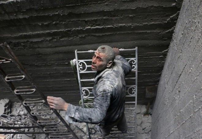 Rejimin kara ve hava saldrlarnn yan sra "a brakma silah" ile de vurduu Dou Guta'da en byk maduriyeti bebekler ve ocuklar yayor. AA'nn grntledii bir ok vakada, bebek ve ocuklarn "alktan kemiklerinin saylr duruma geldii" ancak ocuklarn sessizce lm beklemekten baka areleri olmad grlyor.  <br>  10 soruda Dou Guta'da yaananlar yle: