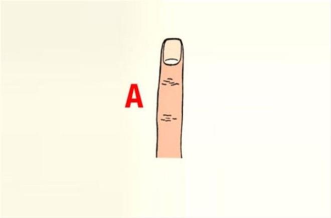 A tipi parmaa sahip insanlar genelde kapal kutu gibidir. Duygularn saklayarak, asla darya yanstmazlar. Dardan souk ve ciddi gzkseler de i dnyalarnda olduka duygusal insanlardr. Salam ve gl bir duru imajlarnn temelini olmutur.