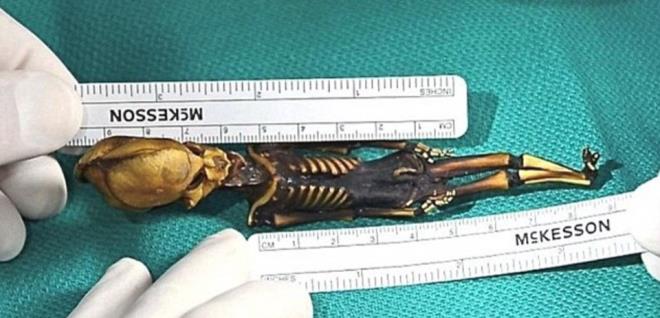 2003 ylnda, ili&#8217;deki Atacama blgesinde, deri bir anta ierisinde terk edilmi bir kilisede bulunan, koni eklindeki bir baa ve 15 cm uzunlua sahip mumyann bir uzaylya ait olabilecei iddia edilmiti.