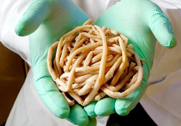 Sizce ylda ka insan yuvarlak solucan yznden lyor?