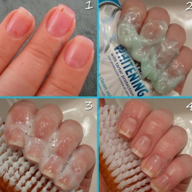 Ojenizi karamadnzda di macunu kullanabilirsiniz. Bunun iin di macunuyla ovalayarak birka dakika bekletin ve ellerinizi ykadktan sonra trnaklarnzn temizlendiini greceksiniz.