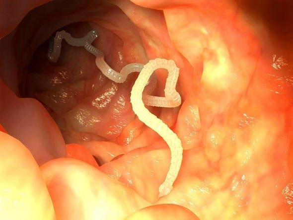 Sizce ylda ka insan barsak kurdu yznden lyor?