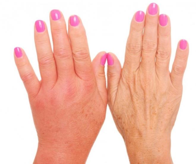 dem ve ikinlik giderici etkisi bulunur.