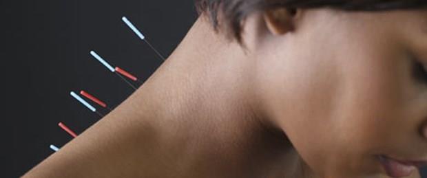 ORULU KMSE AKUPUNKTUR YAPTIRABLR M?    Akupunktur; vcutta belirli noktalara ine batrmak suretiyle eitli hastalklar tedavi  etme metodudur. Akupunktur uygulanmas hlinde, vcudun beslenmesi, gda almas sz  konusu olmadndan, akupunktur yaptrmak orucu bozmaz.