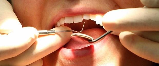 ORULU KMSENN DLERN TEDAV ETTRMES ORUCU BOZAR MI?    Orulu bir kimsenin morfinli veya morfinsiz olarak dilerini tedavi ettirmesi veya ektirmesi  orucu bozmaz. Ancak tedavi esnasnda, kan veya tedavide kullanlan maddelerden herhangi bir eyin yutulmas orucu bozar.