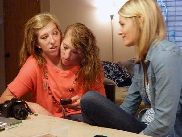 nk daha nce bir vcuda bal olarak yaayan ikizlerin hemen hepsi hayatn kaybetti.