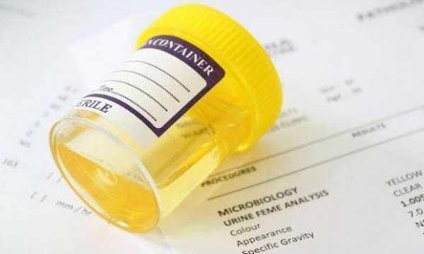 �DRAR VE DI�KIDA KAN    �drarda kan g�r�lmesi pek �nemsenen bir durum olmasada mesane kanserinin belirtisi olabilir. Mesane kanseri, di�er kanser t�rleri gibi kendini hemen belli etmez. Tam tersine son safhada kendini g�sterir.