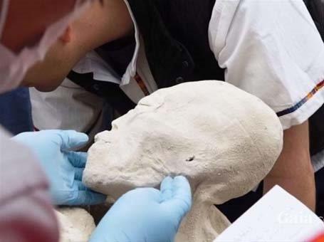 Gnmz insanlarnn aksine ince ve uzun bir kafatas yapsna sahip olan mumyann en dikkat ekici zellii ise  parmakl el ve ayaklara sahip olmas.