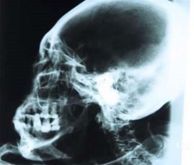 Mera'ya gre mumya, farkl bir insan trne ait olduu ispatlanmas halinde 21. yzyln en byk kefi olabilir.