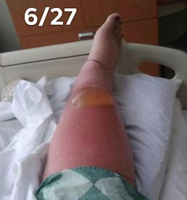 TEMZLE DKKAT; Martinez, yaadklarn ve bacann halini sosyal medya hesabndan paylat. Martinez, masum gibi grnen pedikrn olduka tehlikeli olduunu ve temizlie dikkat edilmesi gerektii konusunda hemcinslerini uyard.