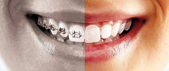 Ortodontist<br>    Ortodontist denilince akla ilk olarak di telleri gelir desek yanl sylemi olmayz. Dilerinizde bir bozukluk varsa ve bunun iin tedavi grdyseniz mutlaka bir ortodontistle karlamsnzdr. Karlatnz ortodontistin ne kadar gler yzl olduuna arm olabilirsiniz. Ancak muhtemelen byle mutlu olmalarnn sebebi ilerinin son derece stressiz olmas.