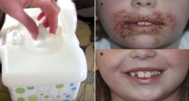 ALMAYIN; Eer iinde 'methylisothiazolinone' maddesi bulunuyorsa kesinlikle almamas gerektiini belirtti.