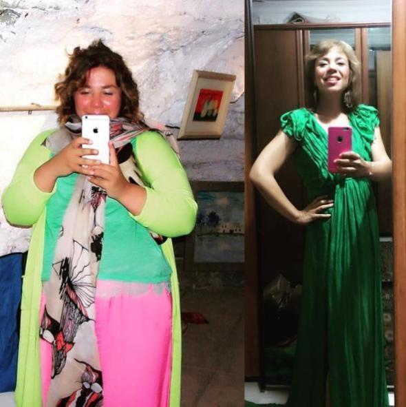 Bozolu 100 kiloya knca Austos 2016'da mide kltme ameliyat olmutu.