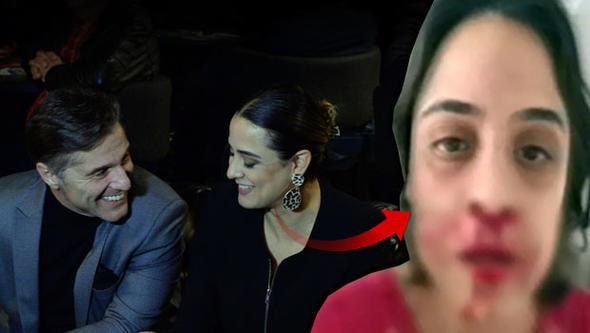 Oyuncu Hazm Krmk nianls Zeynep Tandoan'a iddet uygulad iin karakolluk olmutu. Hastaneden darp raporu alan Zeynep Tandoan&#8217;n kanlar iindeki fotoraf sosyal medyada yaynlanmt.