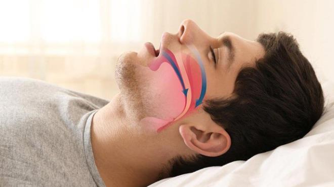 HORLAMA    Burun t�kan�kl��� aile ve sosyal �evreyi de olumsuz etkiler. T�kan�kl�k horlama ve uyku apnesi gibi hastal�klara neden olur. Uyurken kesilen nefes, ani fel� ya da �l�mle sonu�lanabilir.