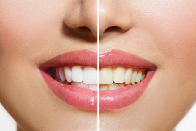 A�IZ VE D�� HASTALIKLARI    Ayn� zamanda burun t�kan�kl��� tat ve koku alma duyusunu azalt�r. Bo�az temizlenmedi�inden burnu t�kanan ki�i s�rekli �ks�r�r. Direk a��zdan al�nan solunum, a��z i�i enfeksiyonuna ve di� etlerinin erken ��r�mesine ortam haz�rlar.