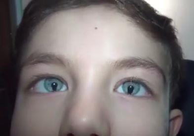 BURSAnn negl ilesinde milyonda bir kiide grlen rahatszla sahip 6 yandaki Emir Kayra Polat?n gzlerinin adeta Kedi gzlerine benzemesi herkesin dikkatini ekiyor. ki gzde ikier iris bulunmas olarak tanmlanan ris Kolobomu rahatszl bulunan ocuun gzlerini grenler aryor.