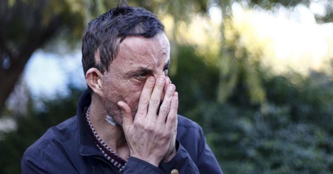 Hemen dndn ve koarak hastaneye geldiini anlatan Acar, yle konutu:    "Arayan Prof. Dr. mer zkan'd, ameliyat olacam syledi. Ameliyata girdim, ok heyecanlydm.     Trkiye'de bir ilk gerekletirildi, ilk yz nakilli hastas oldum. Ameliyattan sonra aynaya baktm, 'Bundan daha iyisi olmazd' dedim. Kendimi tanyamadm. O mutluluun tarifi yok, ok farkl bir duyguydu. Bu, farkl bir yaama balatacak admd."    "H ARKADAIM YOKTU"    Nakil ncesi zorlu bir hayat olduunu,