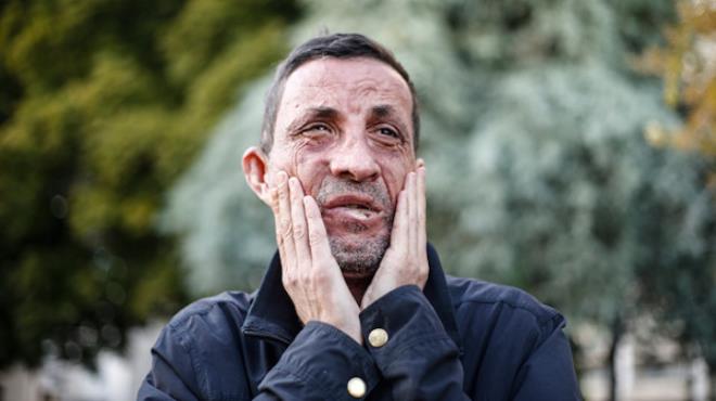 Antalya'nn Manavgat ilesi Gebece kynde dnyaya gelen ve bir aylkken evinde kan yangnda yz yanan Uur Acar, 21 Ocak 2012'de Akdeniz niversitesi Hastanesinde gerekletirilen Trkiye'nin ilk yz nakli ameliyatyla yeni hayatna balad.