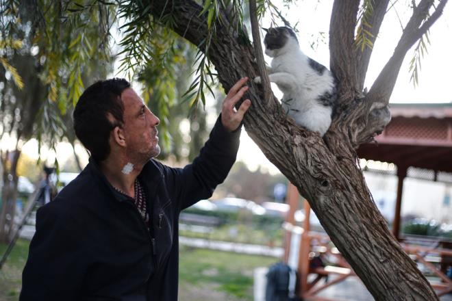 Tp dnyasnda byk ses getiren ameliyatla yeni yzne kavuan Acar, 7 ylda yz fonksiyonlarn byk oranda kullanma kabiliyeti kazand.    Nakil olmadan nce insanlarn yzne bakmaya ekindiini, ocuklarn ise kendisinden korktuu iin sokaa kmadn anlatan Acar, yeni yzyle srekli ar pazar dolatn syledi. Nakil olduu hastanenin otoparknda alan Acar, aynaya bakp, yeni yz iin her gn krediyor.