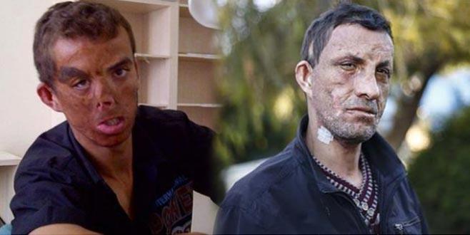 "Her gn sabah yzm ykarken aynaya bakp krediyorum. Yeni yzm yeni hayatm oldu, hayallerim gerekleti. 7 yl rya gibi geti." diyen Acar, i hayatnda en iyi yerlere gelmeyi, salkl bir hayat srmeyi istediini syledi.    Organ nakli arsnda da bulunan Acar, herkesin bir gn organ nakli hastas olabileceini, bunun iin de organ ve kompozit doku bann dier insanlarn hayatna dokunduuna iaret etti.