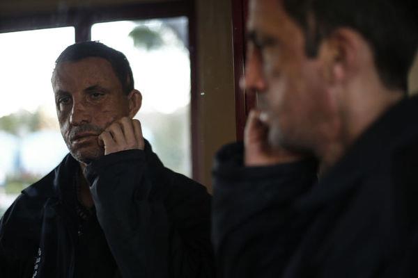 "O MUTLULUUN TARF YOK"    nsanlarn fotoraf ektirmek iin kendisine yakn ilgi gsterdiini belirten Acar, AA muhabirine yapt aklamada, 7 yl nce Akdeniz niversitesi Hastanesinde rutin kontrollerini yaptrdktan sonra otobsle kye dnerken hastaneden nakil iin telefon geldiini syledi.