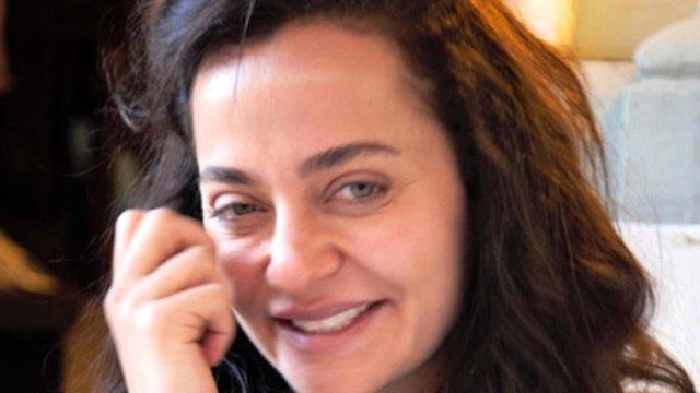 Didem Baln, bir gzellik merkezinde yzne 'Altn ine' ad verilen bir estetik uygulamas yaptrd. Yznde ar yanma ve ilik meydana geldikten sonra doktorun sahte olduunu renen Baln, soluu stanbul Cumhuriyet Basavcl'nda ald.